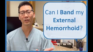 EXTERNAL Hemorrhoid Rubber Banding [upl. by Deerc]