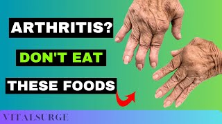 9 Foods To Avoid for Arthritis Stop Now [upl. by Lednahc649]