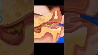 ASMR  Deep Ear Cleaning Animation asmr ytshort animation [upl. by Nnybor]