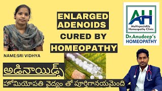 ADENOIDS CURED  ADENOIDS TREATMENT  HOMEOPATHY TREATMENT  WITHOUT SURGERY [upl. by Adnilram]