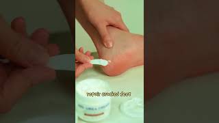 Experience softness and smoothness with Urea Cream today amazon [upl. by Letch992]