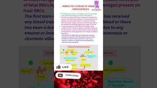 Haemolytic Disease Of Newborn 👶 hdn newborn rh abo bloodtest pathogenesis mbbs neetpg lab [upl. by Conlin]