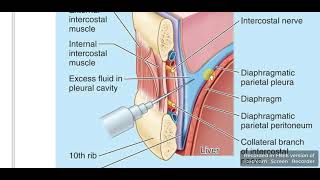 Hemothorax Pneumothorax Hydrothorax [upl. by Gurango]