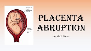 OampG Placenta abruption  definition causes clinical features investigation management [upl. by Nitniuq]