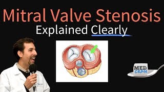 Mitral Valve Stenosis Explained Clearly  Pathophysiology Symptoms Treatment [upl. by Mecke]