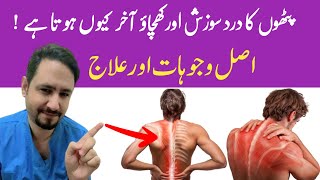 Myalgia Muscle Pain Treatment In Urdu Hindi  Dr Irfan Azeem [upl. by Ahsinrac]