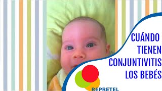 Reconozca la conjuntivitis en bebés  Salud [upl. by Hailee]