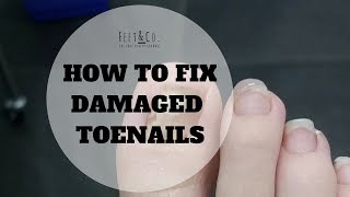 How to fix damaged bad nails [upl. by Carmella]