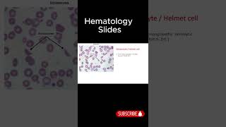 Hematology Slides  HIGH YIELD TOPIC USMLE [upl. by Vaules]