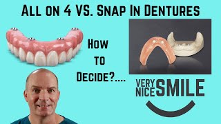 Smyl Manatee  Dental Implant Procedure [upl. by Novy]