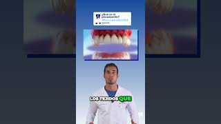 PERIODONTITIS  La principal CAUSA de PÉRDIDA de DIENTES en adultos [upl. by Nosyaj]