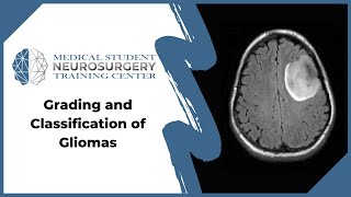 Grading and Classification of Gliomas [upl. by Inava]