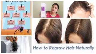 Reequil Hair fall control serumDemoHonest review Scalp serum to stop Hair fall Manisha Pranay [upl. by Yud]