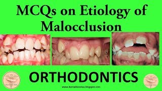 MCQs in Orthodontics  Etiology of Malocclusion  Dentosphere [upl. by Angle791]