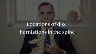 Herniated spinal discs  Where do disc prolapses occur [upl. by Pincus918]