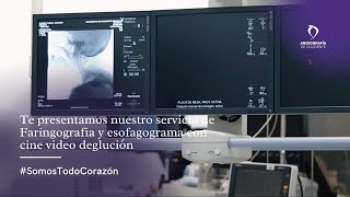 Te presentamos nuestro servicio de Faringografia y esofagograma con cine video deglución [upl. by Shermy]