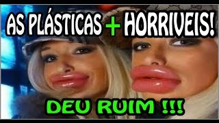 🔴 Plásticas Terríveis As Plásticas dos famosos que deram errado PARTE 1 [upl. by Alameda]