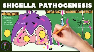 Shigella Pathogenesis Simplified [upl. by Coppinger]