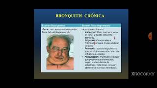 Seminario síndromes bronquiales [upl. by Airdna]