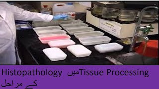 tissue processing in histopathology lab [upl. by Starlene]