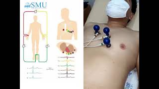 Obtaining an electrocardiogramm [upl. by Nakre]