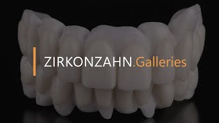 Complete Prettau® zirconia restoration on implants  ZirkonzahnGalleries [upl. by Adnovad]