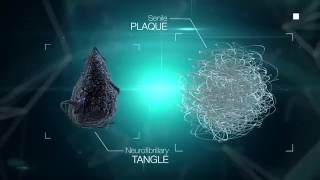 Beta amyloid and Tau proteins HUMAN transglutaminase substrates LIKE GLUTEN and CASEIN LECMA [upl. by Negris]