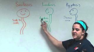 Scoliosis Lordosis and Kyphosis [upl. by Ahseryt]