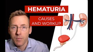 Hematuria causes and evaluation of blood in your urine [upl. by Adnilahs]