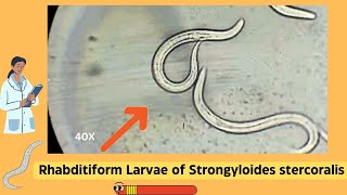 Understanding Strongyloides Rhabditiform Larvae A Comprehensive Guide  Parasitology [upl. by Yffub339]