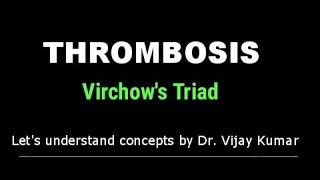 Thrombosis Pathology  Virchows Triad  Thrombus Formation  Pathology Lectures [upl. by Yllus]