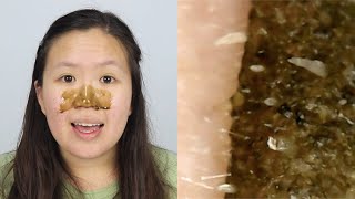 VZA Green Tea Blackhead Peel Off Mask  UNDER A MICROSCOPE [upl. by Lechar]