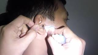 Suctioning of Wax from Mans Ear Is it an Earwax [upl. by Gitlow]