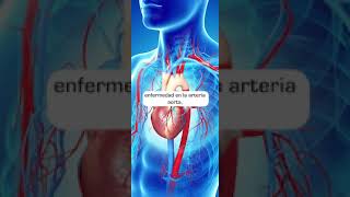 Hablemos de hemodinamia cardiología intervencionista  ¿Qué es [upl. by Neeleuqcaj]