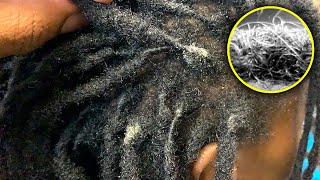 Remove Lint From Dreadlocks Using THIS [upl. by Lewie375]