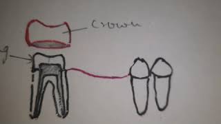 Mouth Preparation in Removable partial dentures [upl. by Greenstein854]