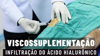 INFILTRAÇÃO NO JOELHO DO ÁCIDO HIALURÔNICO VISCOSSUPLEMENTAÇÃO parte 1 [upl. by Dlorah]