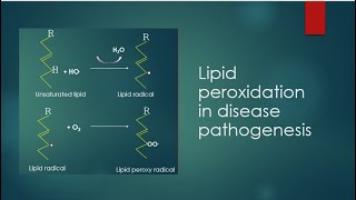 Lipid peroxidation in disease pathogenesisMolecular ScienceDr Seema Kumari [upl. by Gottwald]