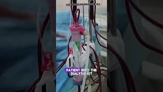 How Hemodialysis Filters Blood  Quick Overviewhemodialysis kidneydialysis dialysistreatment [upl. by Tutt]