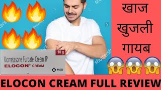 Elocon Cream Full review Effects and Side Effects Best for Fungal Infection खाज खुजली गायब 🔥😃👍😎 [upl. by Yoshi]