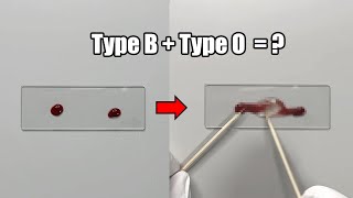 What Happens When Two Different Blood Types are Mixed Together [upl. by Gerianne]