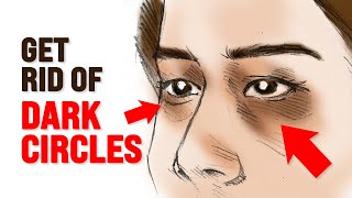 What Causes Dark Circles Under Eyes – Dr Berg [upl. by Durwood]