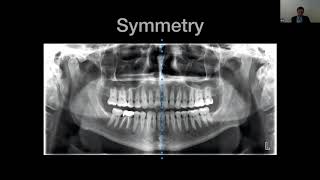 CBCT Interpretation Crash Course for the New User with Dr Peter Green [upl. by Marcelle604]