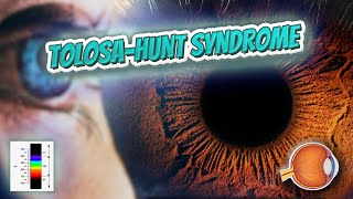 Tolosa–Hunt syndrome Your EYEBALLS 👁️👁️💉😳💊🔊💯✅ [upl. by Brenk833]