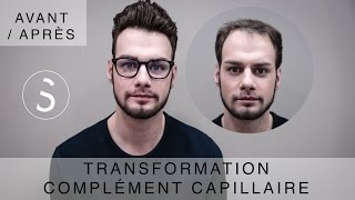 ► Complément capillaire  Transformation  BYSIX [upl. by Teeniv]