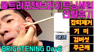 어드마이어마이스킨 DAY6 신기술 젓가락 신공  잡티제거 울트라포텐브라이트닝세럼  Admire my skin ultra potent brightening serum [upl. by O'Conner]