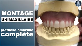 Unimaxillaire  Montage des dents  Prothèse amovible complète  Prothèse dentaire  © [upl. by Allevon]