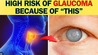 SHOCKING reasons why you will have glaucoma [upl. by Arleyne]