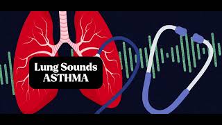 Understanding Asthma Lung Sounds Accurate Lung Assessment [upl. by Poucher]