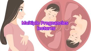 Multiple pregnancies lectures part 4 TTTS twin twin transfusion syndrome obs obstretic [upl. by Kehoe]